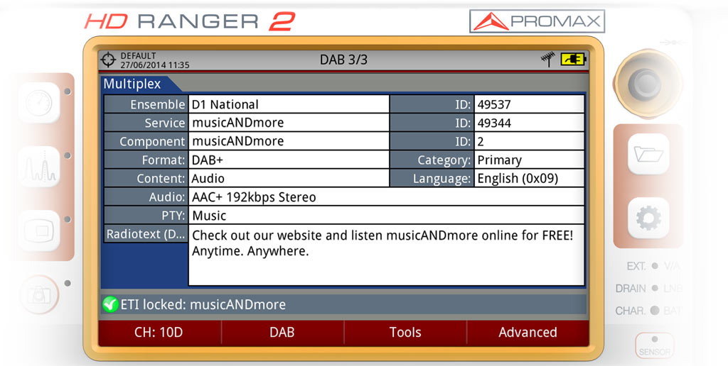 Data taken from the broadcaster multiplex in a DAB+ signal including: format (DAB or DAB +), type of audio (audio codec and bitrate), PTY (program type), radio text content, etc